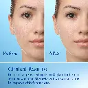 302994910106 (2)_result.webp